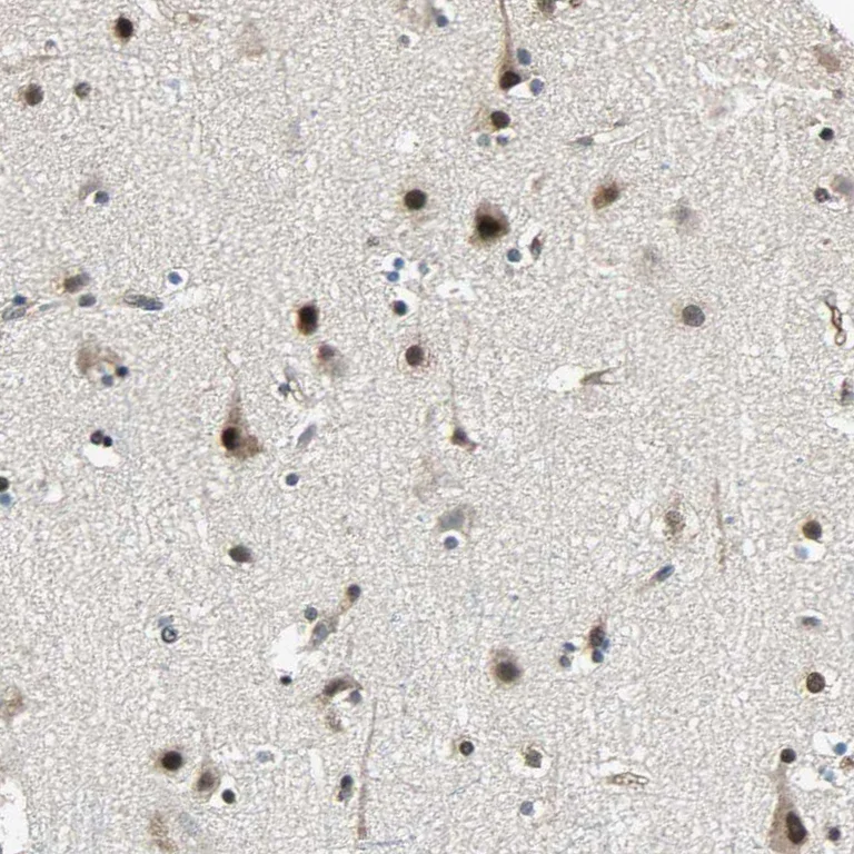 Immunohistochemistry (Formalin/PFA-fixed paraffin-embedded sections) - Anti-NR2C2 Antibody (AB327185)