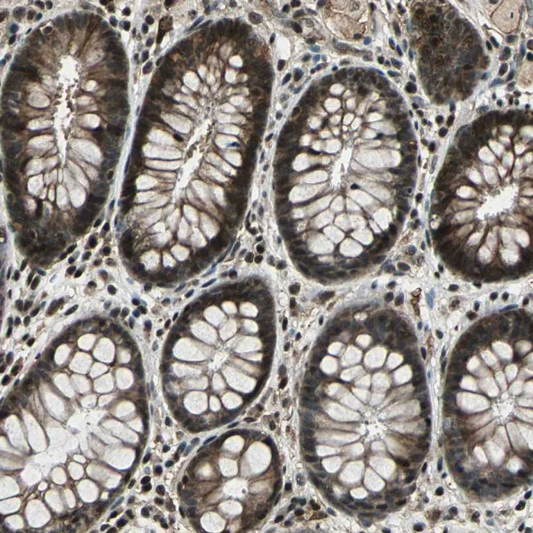 Immunohistochemistry (Formalin/PFA-fixed paraffin-embedded sections) - Anti-NR2C2 Antibody (AB327185)