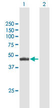 Western blot - Anti-NR2E3/RNR antibody (AB172542)