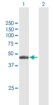 Western blot - Anti-NR2E3/RNR antibody (AB172542)