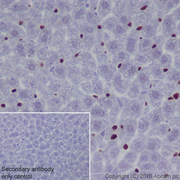 Immunohistochemistry (Formalin/PFA-fixed paraffin-embedded sections) - Anti-NR2F2 antibody [EPR18442] (AB211776)