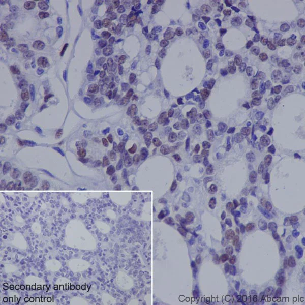 Immunohistochemistry (Formalin/PFA-fixed paraffin-embedded sections) - Anti-NR2F2 antibody [EPR18442] (AB211776)