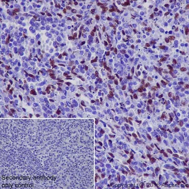 Immunohistochemistry (Formalin/PFA-fixed paraffin-embedded sections) - Anti-NR2F2 antibody [EPR18442] (AB211776)
