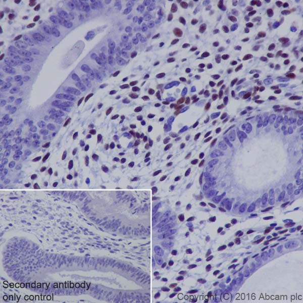 Immunohistochemistry (Formalin/PFA-fixed paraffin-embedded sections) - Anti-NR2F2 antibody [EPR18442] (AB211776)