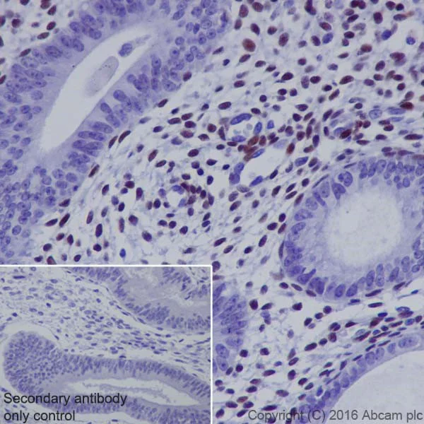 Immunohistochemistry (Formalin/PFA-fixed paraffin-embedded sections) - Anti-NR2F2 antibody [EPR18442] (AB211776)