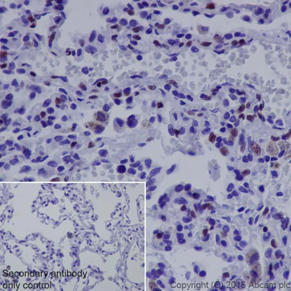 Immunohistochemistry (Formalin/PFA-fixed paraffin-embedded sections) - Anti-NR2F2 antibody [EPR18442] (AB211776)
