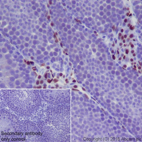 Immunohistochemistry (Formalin/PFA-fixed paraffin-embedded sections) - Anti-NR2F2 antibody [EPR18442] - BSA and Azide free (AB240386)