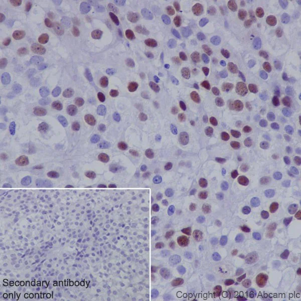 Immunohistochemistry (Formalin/PFA-fixed paraffin-embedded sections) - Anti-NR2F2 antibody [EPR18442] - BSA and Azide free (AB240386)