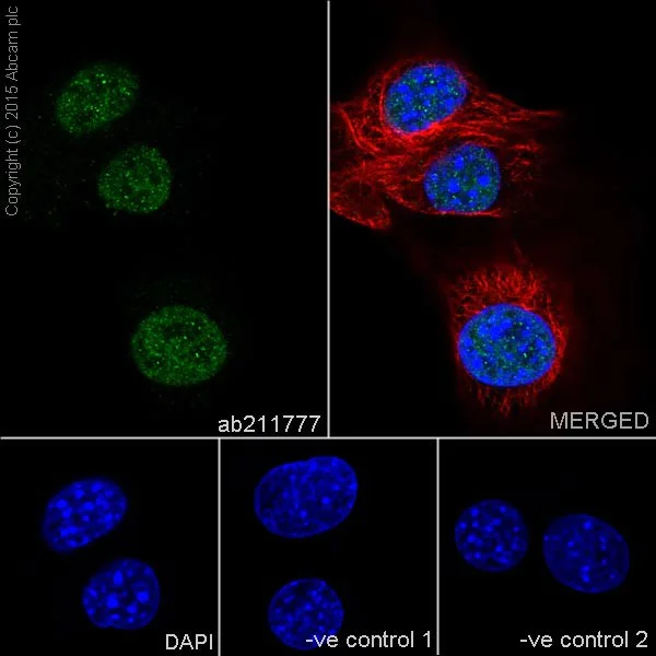 Immunocytochemistry/ Immunofluorescence - Anti-NR2F2 antibody [EPR18443] (AB211777)