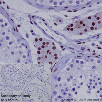 Immunohistochemistry (Formalin/PFA-fixed paraffin-embedded sections) - Anti-NR2F2 antibody [EPR18443] (AB211777)