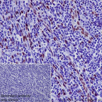 Immunohistochemistry (Formalin/PFA-fixed paraffin-embedded sections) - Anti-NR2F2 antibody [EPR18443] (AB211777)
