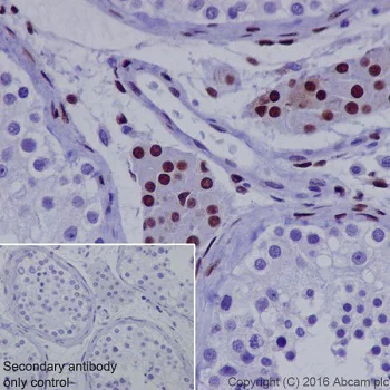 Immunohistochemistry (Formalin/PFA-fixed paraffin-embedded sections) - Anti-NR2F2 antibody [EPR18443] - BSA and Azide free (AB240387)