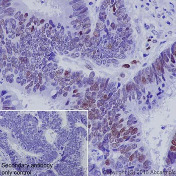Immunohistochemistry (Formalin/PFA-fixed paraffin-embedded sections) - Anti-NR2F2 antibody [EPR18443] - BSA and Azide free (AB240387)