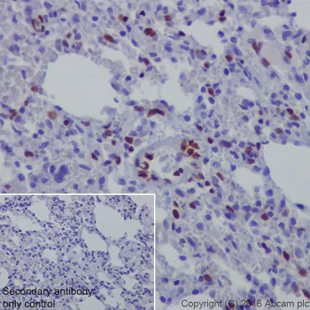 Immunohistochemistry (Formalin/PFA-fixed paraffin-embedded sections) - Anti-NR2F2 antibody [EPR18443] - BSA and Azide free (AB240387)