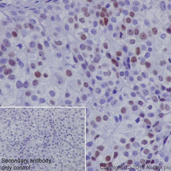 Immunohistochemistry (Formalin/PFA-fixed paraffin-embedded sections) - Anti-NR2F2 antibody [EPR18443] - BSA and Azide free (AB240387)