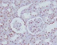 Immunohistochemistry (Formalin/PFA-fixed paraffin-embedded sections) - Anti-NR2F2 antibody [H7147] (AB41859)