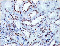 Immunohistochemistry (Formalin/PFA-fixed paraffin-embedded sections) - Anti-NR2F2 antibody [H7147] (AB41859)