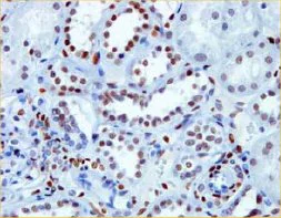 Immunohistochemistry (Formalin/PFA-fixed paraffin-embedded sections) - Anti-NR2F2 antibody [H7147] (AB41859)