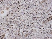 Immunohistochemistry (Formalin/PFA-fixed paraffin-embedded sections) - Anti-NR2F6/EAR-2 antibody (AB137496), expandable thumbnail