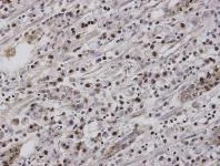 Immunohistochemistry (Formalin/PFA-fixed paraffin-embedded sections) - Anti-NR2F6/EAR-2 antibody (AB137496)
