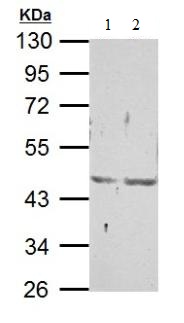 Western blot - Anti-NR2F6/EAR-2 antibody (AB137496), expandable thumbnail