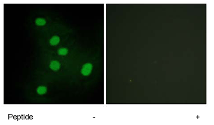 Immunocytochemistry/ Immunofluorescence - Anti-NR2F6/EAR-2 antibody (AB65012)