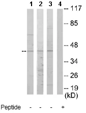 Western blot - Anti-NR2F6/EAR-2 antibody (AB65012)