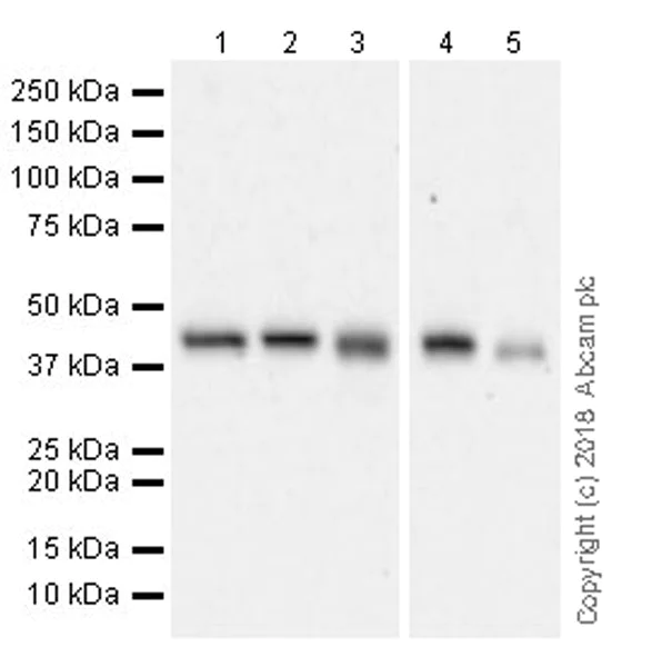 Western blot - Anti-NR2F6/EAR-2 antibody [EPR22260] (AB223265)