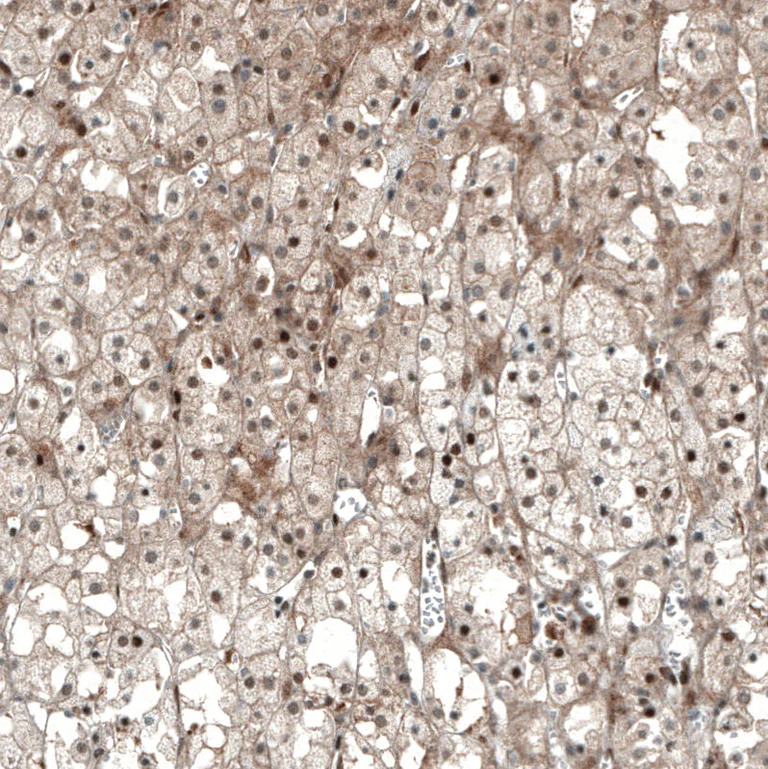 Immunohistochemistry (Formalin/PFA-fixed paraffin-embedded sections) - Anti-NR5A1 Antibody [CL9101] (AB327126)