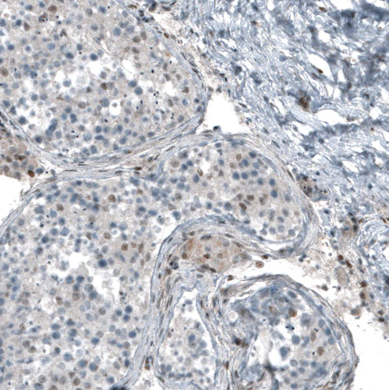 Immunohistochemistry (Formalin/PFA-fixed paraffin-embedded sections) - Anti-NR5A1 Antibody [CL9101] (AB327126)