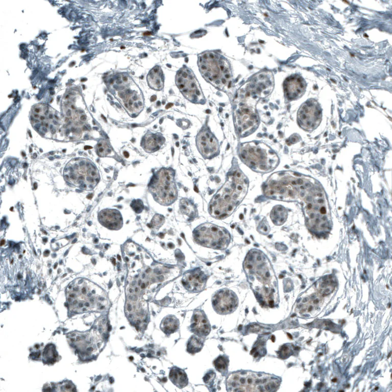 Immunohistochemistry (Formalin/PFA-fixed paraffin-embedded sections) - Anti-NR5A1 Antibody [CL9101] (AB327126)