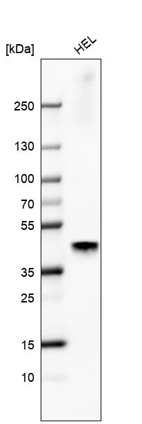 Western blot - Anti-NR5A1 Antibody [CL9101] (AB327126)