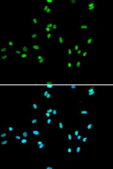 Immunocytochemistry/ Immunofluorescence - Anti-NR5A2 / LRH1 antibody - C-terminal (AB189876), expandable thumbnail