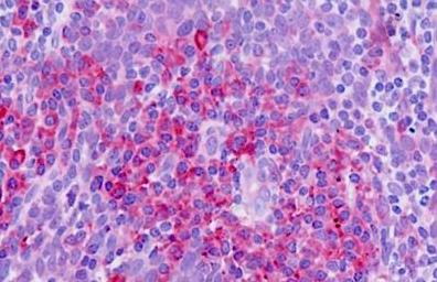 Immunohistochemistry (Formalin/PFA-fixed paraffin-embedded sections) - Anti-NRAMP1 antibody (AB211448)