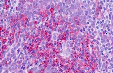 Immunohistochemistry (Formalin/PFA-fixed paraffin-embedded sections) - Anti-NRAMP1 antibody (AB211448)