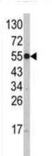 Western blot - Anti-NRAMP1 antibody (AB211448)