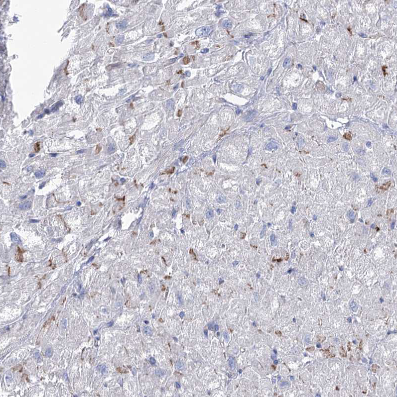 Immunohistochemistry (Formalin/PFA-fixed paraffin-embedded sections) - Anti-NRAP antibody (AB122427)