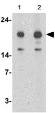 Western blot - Anti-NRAS antibody (AB167136)