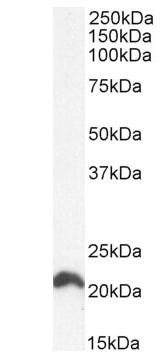 Western blot - Anti-NRAS antibody (AB77392)