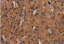 Immunohistochemistry (Formalin/PFA-fixed paraffin-embedded sections) - Anti-NRAS antibody - C-terminal (AB198820)