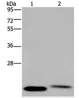 Western blot - Anti-NRAS antibody - C-terminal (AB198820)