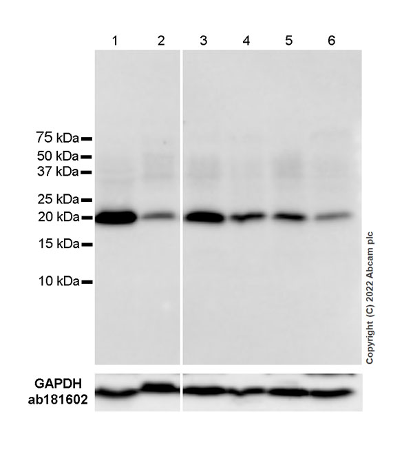 Western blot - Anti-NRAS antibody [EPR25186-24] (AB300431), expandable thumbnail