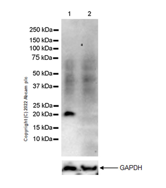 Western blot - Anti-NRAS antibody [EPR25186-24] (AB300431), expandable thumbnail