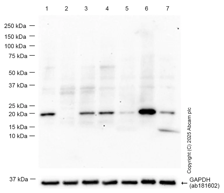 Western blot - Anti-NRAS antibody [EPR25186-24] (AB300431)