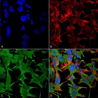Immunocytochemistry/ Immunofluorescence - Anti-NrCAM antibody [S364-51] - Neuronal Marker (AB186247)