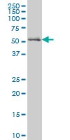 Western blot - Anti-NRF1 antibody [2F9] (AB55744), expandable thumbnail
