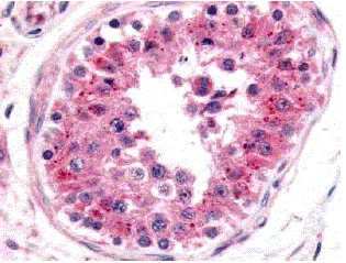 Immunohistochemistry (Formalin/PFA-fixed paraffin-embedded sections) - Anti-NRF1 antibody (AB34682)
