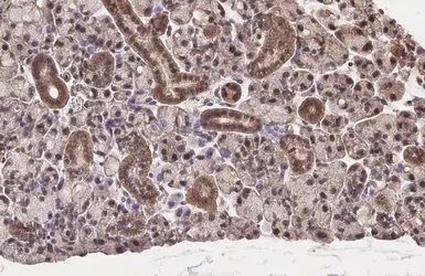 Immunohistochemistry (Formalin/PFA-fixed paraffin-embedded sections) - Anti-NRF2 antibody [HL1021] - BSA and Azide free (AB313825), expandable thumbnail