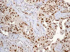 Immunohistochemistry (Formalin/PFA-fixed paraffin-embedded sections) - Anti-Nrf2 (phospho S40) antibody [EP1809Y] (AB76026)