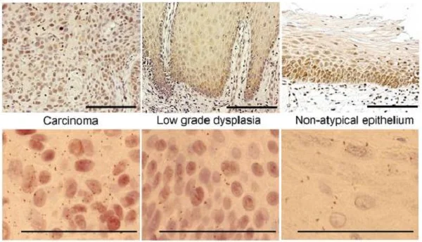 Immunohistochemistry (Formalin/PFA-fixed paraffin-embedded sections) - Anti-Nrf2 (phospho S40) antibody [EP1809Y] (AB76026)
